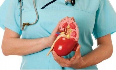 human kidney as habitat of alveococcus parasite