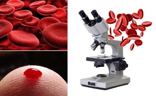 haemo scanning of blood
