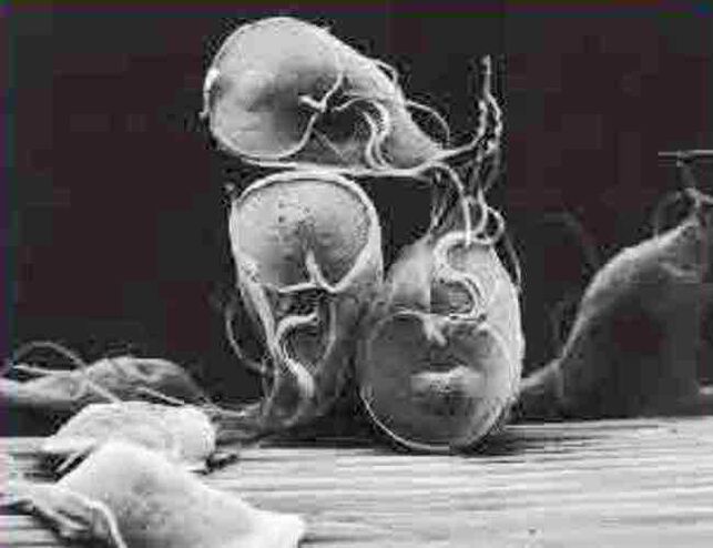 parasitic protozoar giardia